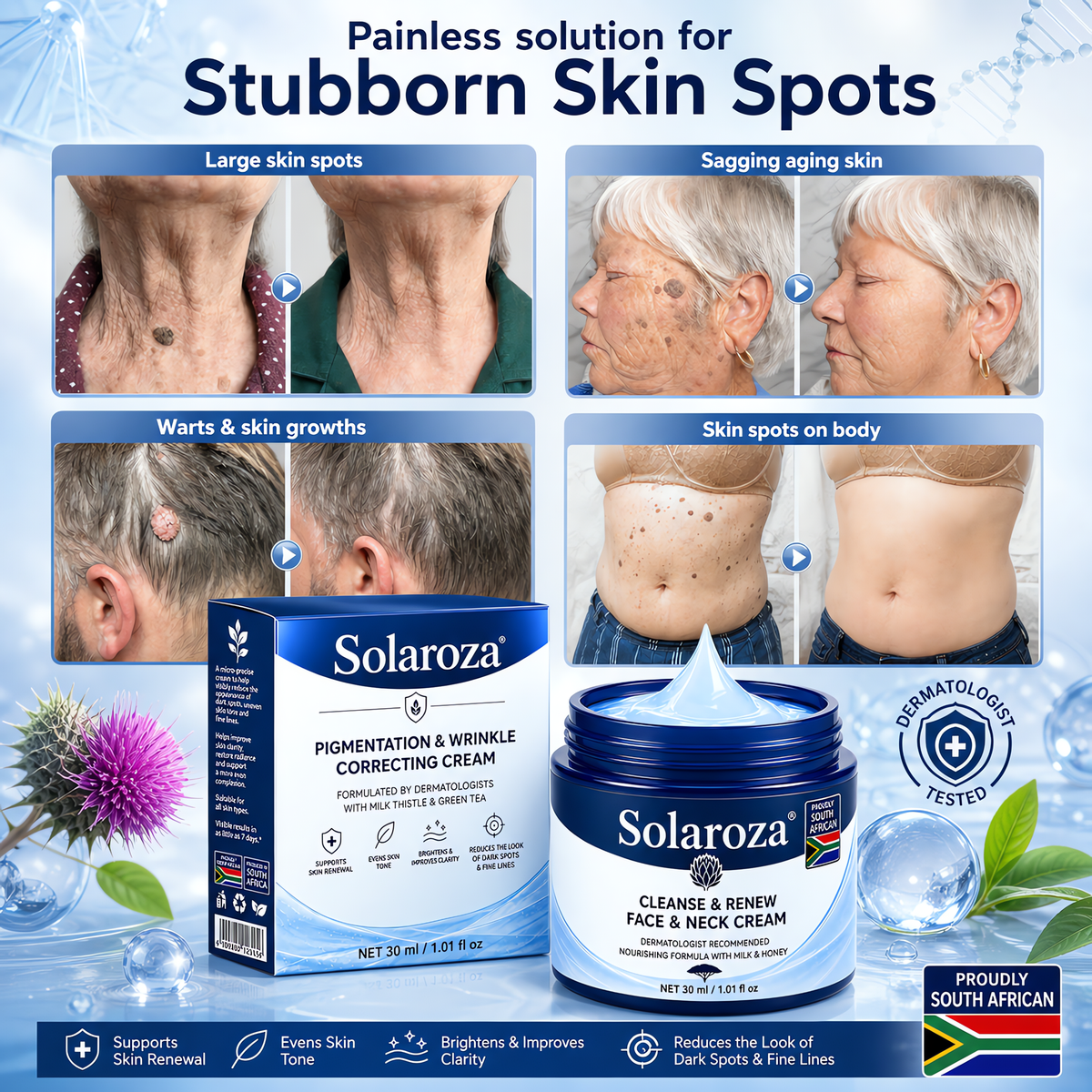 🧑‍⚕️ 𝐒𝐨𝐥𝐚𝐫𝐨𝐳𝐚® 7-Day Skin Tag & Pigmentation Removal Cream (Painless Formula – Scar-Free) 🇿🇦