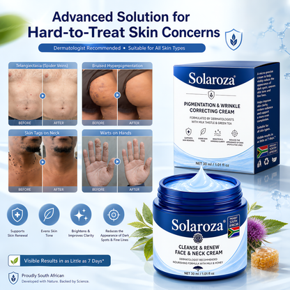 🧑‍⚕️ 𝐒𝐨𝐥𝐚𝐫𝐨𝐳𝐚® 7-Day Skin Tag & Pigmentation Removal Cream (Painless Formula – Scar-Free) 🇿🇦